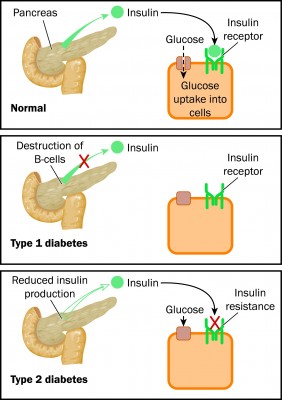 Overweight or obese health problems